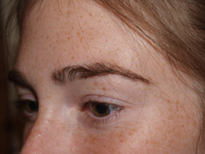 eyebrow and eyelashes - patient 124 - after 2
