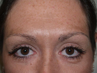 eyebrow and eyelashes - patient 114 - after 2