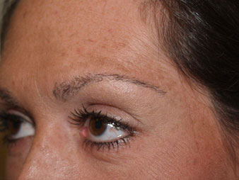 eyebrow and eyelashes - patient 114 - after 4