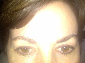 eyebrow and eyelashes - patient 116 - after 1