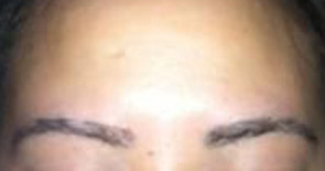 eyebrow and eyelashes - patient 117 - after 1