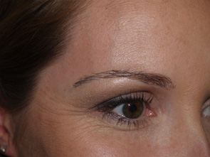 eyebrow and eyelashes - patient 111 - after 2