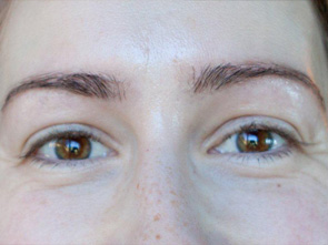 eyebrow and eyelashes - patient 112 - after 1