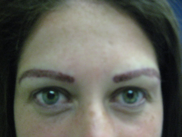 eyebrow and eyelashes - patient 91 - after 1