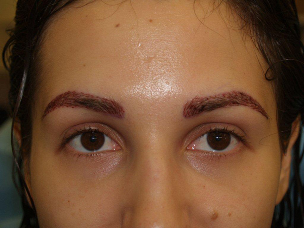 eyebrow and eyelashes - patient 93 - after 1