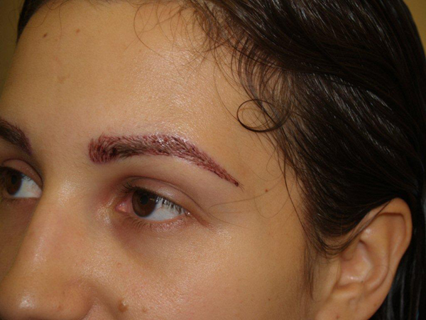 eyebrow and eyelashes - patient 93 - after 3