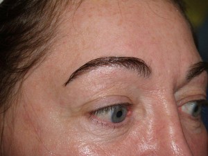 Miami, Fl. Eyebrow and Eyelashes Photo - Patient 1 - After 1