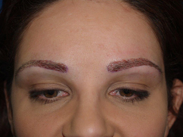 eyebrow and eyelashes - patient 98 - after 1
