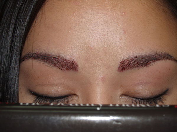 eyebrow and eyelashes - patient 107 - after 1