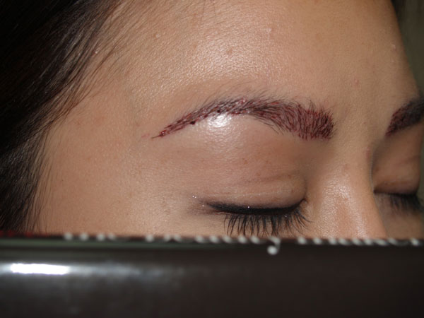 eyebrow and eyelashes - patient 107 - after 2