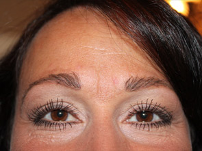 eyebrow and eyelashes - patient 110 - after 1