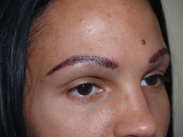 eyebrow and eyelashes - patient 69 - after immediately 2