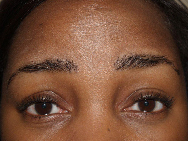 eyebrow and eyelashes - patient 73 - after 1